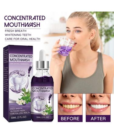 Concentrated Mint Mouthwash for Fresh Breath Plaque Removal & Teeth Whitening - 59ml | International Shipping - Buy Online on SooperMarket.com
