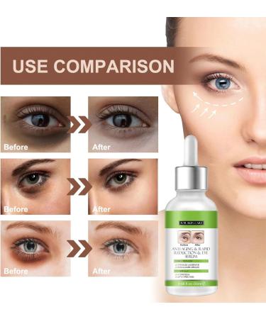 Eye Serum For Firm Skin & Tight Around Eye Eye Serum For Dark Circles & Puffy Eyes Bags Under Eyes Treatment For Women & Men Anti Wrinkle & Anti Aging Eye Serum Reduce Fine Lines - Buy Online on SooperMarket.com