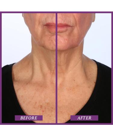 PRAI Beauty Ageless Throat & Decolletage Day Creme 15ml - Youthful Skin Solution - Buy Online on SooperMarket.com