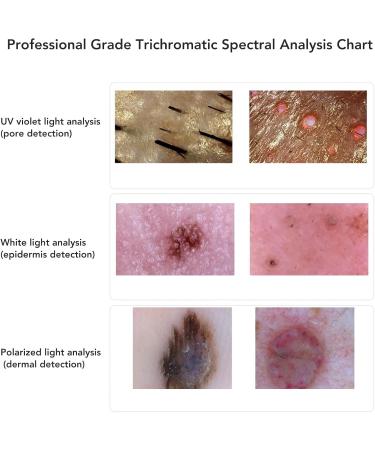 Skin Diagnosis Hair Analyzer 800x Hair Scalp Detector With 2MP USB HD Electronic Digital Microscope - Buy Online on SooperMarket.com