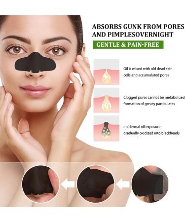 Nose Strips 20 Pcs for Blackheads - Deep Cleansing Pore Strips for Men & Women - Blackhead Remover - Buy Online on SooperMarket.com