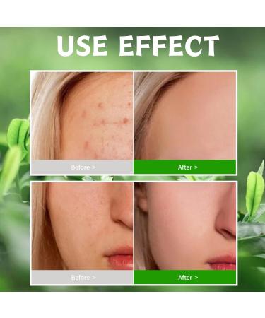 Tea Tree Face Scrub Face Exfoliator Tea Tree Body Scrub Body Exfoliator Moisturizing Body Spa Care Face Skin Care Scrub For Bikini Area Neck Butt Back Acne Armpit Dry & Dull Skin - Buy Online on SooperMarket.com