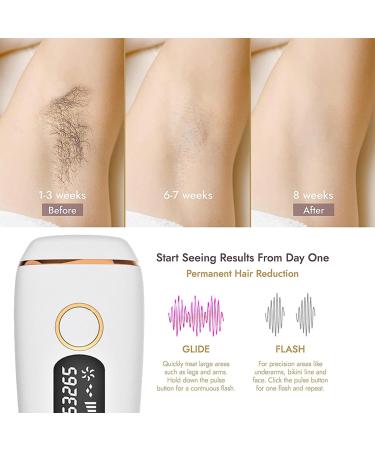 Intelligent Induction Laser Hair Removal Kit - Mild Painless Whole Body Use | Shop Now for Safe Effective Hair Removal Solutions - Buy Online on SooperMarket.com