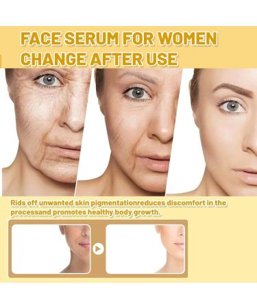 Turmeric Dark Spot Correcting Serum Niacinamide Serum Hydrating Serum Anti Aging Brightening Face Serum For Pure Skin Glow Face Serum Reduce Wrinkles Acne For Face Moisturizes Face Skincare - Buy Online on SooperMarket.com