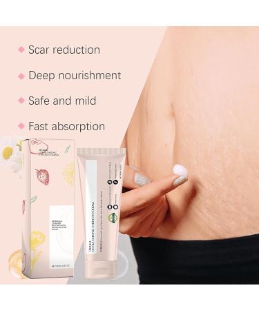 Stretch Marks Removal Pregnancy Stretch Mark Cream Anti Stretch Marks Body Cream for Women Scar Removal Cream Maternity Repair Moisturising Cream & Softening Mild & Caring - Buy Online on SooperMarket.com