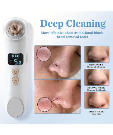 Hohotti Blackhead Remover Vacuum with Camera | USB Rechargeable Pore Vacuum for Face | 6 Suction Heads & 5 Modes | Acne Extractor Tool Kit - Buy Online on SooperMarket.com