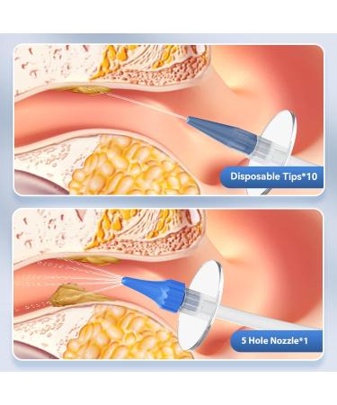 Qimic Ear Wax Removal Kit - Safe & Effective Ear Irrigation Flushing | Complete Cleaning Kit with 10 Replaceable Tips for Home Use - Buy Online on SooperMarket.com