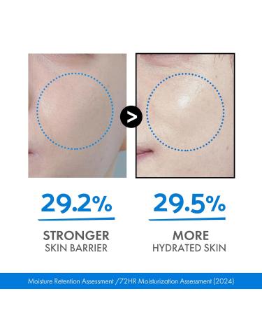 DASHU Boy Blue Sedum Lotion - Korean Day & Night Face Moisturizer with 8 Hyaluronic Acids | Hydrating Barrier Repair Lotion for Men 5.07 fl oz - Buy Online on SooperMarket.com