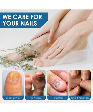 Fungal Nail Treatment Serum Extra Strong Antifungal Nail Treatment for Toenails/Fingernails Improve Thickening/Yellowed/Discolored Nails Original(nail Fungal Serum) - Buy Online on SooperMarket.com