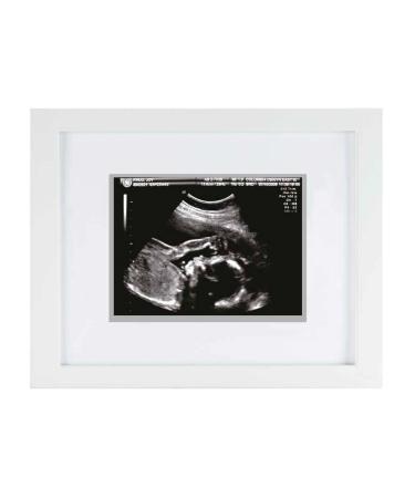 Pearhead Sonogram Keepsake Frame Mothering Sunday Mother's Day Expecting or New Mum Gift White White Sonogram Frame