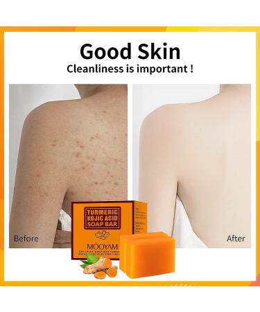 Kojic Acid Turmeric Soap 200g/7OZ - Skin Brightening, Dark Spot Treatment, Acne Face Wash - Buy Online on SooperMarket.com