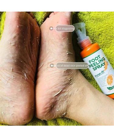 Foot Peeling Spray with Orange Oil Exfoliate Dead Skin & Calluses Fast | Hydrating & Nourishing Formula - Buy Online on SooperMarket.com