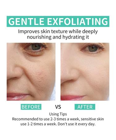 Glycolic Acid 35% Peel Pads with Vitamins B5, C & E - Anti-Aging Formula for Dark Spots, Acne, Fine Lines & Wrinkles - 50 Pads - Buy Online on SooperMarket.com