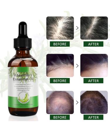 100% Pure Rosemary Oil for Hair & Scalp - Natural Hair Growth & Nourishing Aromatherapy (120ml 2 Pack) - Buy Online on SooperMarket.com
