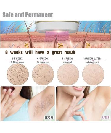 Unlimited Flash Hair Removal Laser - Mild Painless Face & Body Hair Remover for Legs Armpits & Bikini Area - Buy Online on SooperMarket.com