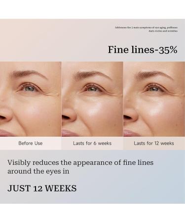 Shichangda Eye Cream Stick | Wrinkles Collagens Moisture Balm | Collagens Multi Balm Stick | Anti-Aging Reduce Under The Eyes Puffiness | Boosts Radiance & Elasticity - Buy Online on SooperMarket.com