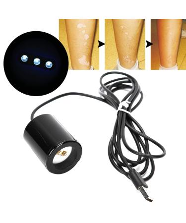 UV 308NM Vitiligo Physiotherapy Instrument for Psoriasis, Eczema & Pityriasis Rosea - Buy Online on SooperMarket.com