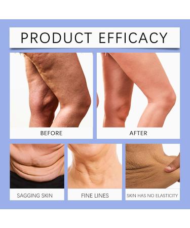 Firming Cream For Loose Skin Belly Belly Firming Cream Anti Cellulite Cream For Skin Tightening Skin Tightening Cream Body Belly Firming Body Cream For Belly Bum & Legs Cellulite Slimming Cream - Buy Online on SooperMarket.com