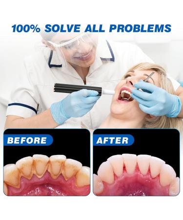 HassoKon Teeth Cleaning Kit - 4 Adjustable Modes, 4 Heads, IPX6 Waterproof (Black) - Buy Online on SooperMarket.com