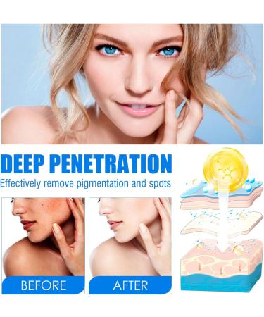 Dark Spot Remover Night Cream Anti Wrinkle Face Moisturiser Dark Spot Corrector For Face&Body Face Care Cream For Hydrating Firming Tightening Skin Face Cream For Women and Men - Buy Online on SooperMarket.com