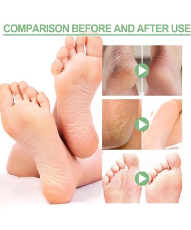 Trendyfave Foot Care Cream Foot Cream For Cracked Heels And Dry Skin Cracked Heel Repair Cream With Vitamin C And Aloe Vera For Deep Moisturizing Callus Remover And Soften Skin Care Hands & Feet - Buy Online on SooperMarket.com