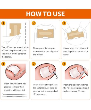 152-Piece Ingrown Toenail Tool Set | Toenail Correction Patch Clasp & Files for Pain Relief - Ship Internationally - Buy Online on SooperMarket.com