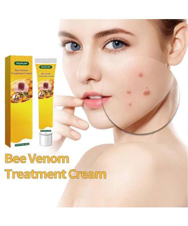 FROPUN Bee Venom Treatment Cream | Acne & Skin Repair | Hydrating Cream for Men & Women | 1 Fl Oz - Buy Online on SooperMarket.com