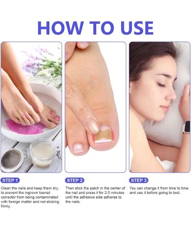 Toen il Correction Sticker 100Pcs: N il Repair P tches Restores Appearance of Discolored or Damaged Nails Foot Care - Buy Online on SooperMarket.com