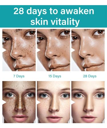 Skin Whitening Cream | Armpit & Underarm Lightening | Dark Spot Corrector for Body | 2oz Intimate Area Bleaching Solution - Buy Online on SooperMarket.com