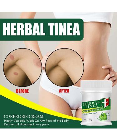 Endxedio Herbal Tinea Corporis Cream - Skin Relief & Anti-Itch Ointment (3pcs) - Buy Online on SooperMarket.com