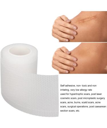 Silicone Scar Tape Roll - Multipurpose, Moisturizing, and Safe for Repeated Sticking - Buy Online on SooperMarket.com