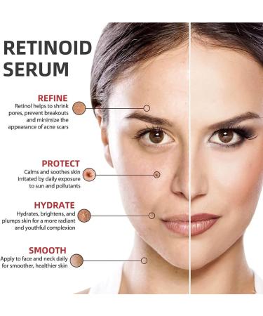 Face Moisturiser Retinoid 2% Emulsion Retinol Serum High Strength for Face Retinol Face Serum Anti Wrinkle Serum Fade Fine Lines Acne Reduced Skin Repair Serum for Women & Men 30ml 1PC Retinoid 2% Emulsion - Buy Online on SooperMarket.com