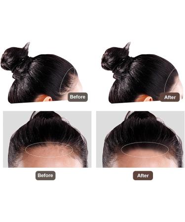 Hairline Powder Hairline Shadow Pressed Powder Instantly Conceals Alopecia White Hair Root Cover Temporary Hair Shading Powder for Thinning Bald Spots Windproof Sweatproof 12g Dark Brown - Buy Online on SooperMarket.com