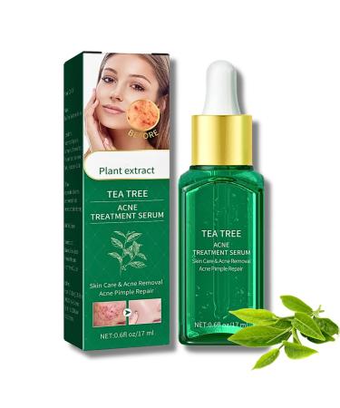 Tea Tree Ance Treatment Serum Tea Tree Oil For Skin Tea Tree Essential Oils Anti-Pimples and Acne Moisturizer and Brighten Skin.Tea Tree Oil for Diffuser Humidifier DIY Home Office 17ml