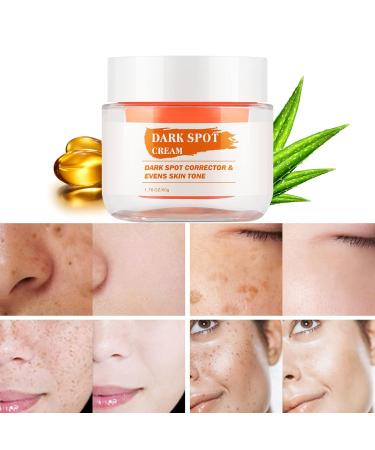 Dark Skin Peeling Oil and Dark Spot Correcting Cream - Extra Strength Exfoliating Solution - Buy Online on SooperMarket.com