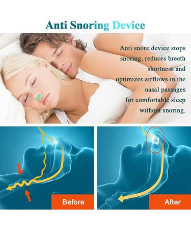 Robesty Anti Snoring Upgrade Nose Air Purifier Vents Plugs Clip | Snoring Reduce for Women Men | Stop Snoring Sleep Aid | Nasal Snore Reducing for Better Sleep | Green - Buy Online on SooperMarket.com