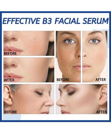 Niacinamide 5% Serum Anti Aging Serum Hyaluronic Acid For Face Hydrated Dark Spot Remover Brightening Serum for Blemish-Prone Dull Skin Face Serum for Women Men Skin Care - Buy Online on SooperMarket.com