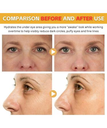 Retinol Eye Cream Retinol Peptide Anti Wrinkle Eye Cream Anti Aging Eye Cream for Dark Circles and Puffy Eyes Under Eye Cream for Women/Men Skincare Fine Lines Improve Skin Tone 30g - Buy Online on SooperMarket.com