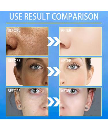Dark Spot Remover Night Cream Anti Wrinkle Face Moisturiser Dark Spot Corrector For Face&Body Face Care Cream For Hydrating Firming Tightening Skin Face Cream For Women and Men - Buy Online on SooperMarket.com