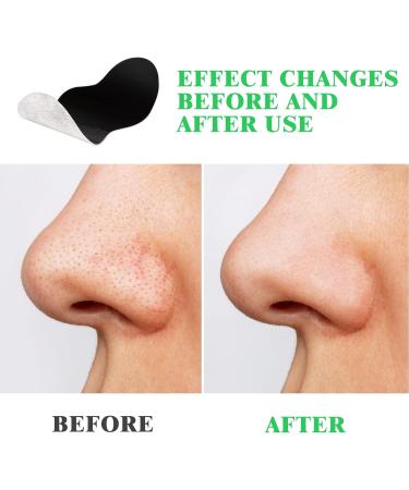 80 Pcs Nose Strips Pore Blackhead Remover Strips Nose Charcoal Bamboo Deep Cleansing of Blackheads Remover to All Skin Types Nose Blackhead Removal Skin Care at Home for Women Men(Black) - Buy Online on SooperMarket.com