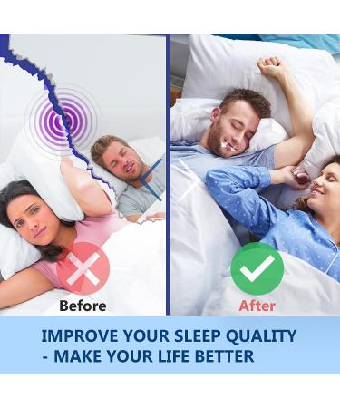 Mouth Tape for Sleeping - Reduce Snoring, Enhance Nasal Breathing - 120PCS - Buy Online on SooperMarket.com