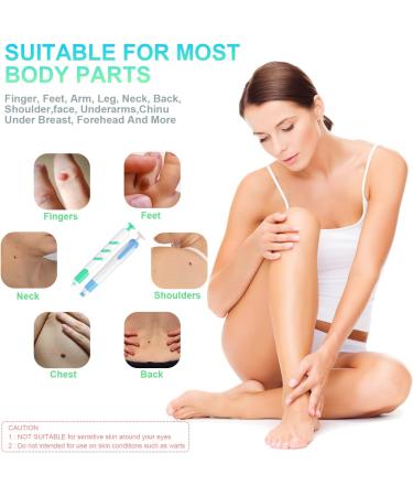 New Version Auto Skin Tag Remover Kit 2-Set Painless Skin Tag Removal Kit Tools for (1-9mm) Skin Tags (includes 100 Removal Bands & 36 Repair Patches & 20 Pcs Cleansing Wipes) Blue Green 2pcs Kit - Buy Online on SooperMarket.com