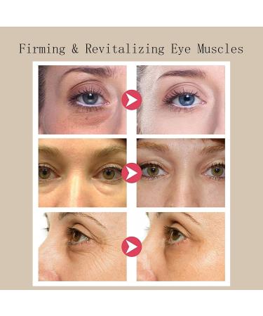 Revive Eye Serum: Ginseng + Retinal Korean Eye Cream for Dark Circles and Puffy Eyes Anti Wrinkle Eye Cream Anti Aging Under Eye Cream Eye Bags Remover Eye Serum for All Skin Types - Buy Online on SooperMarket.com
