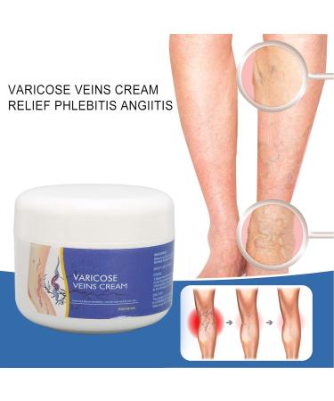 50g Natural Varicose Veins Cream | Leg Circulation & Spider Vein Remover | Cooling Effect | Ointment - Buy Online on SooperMarket.com