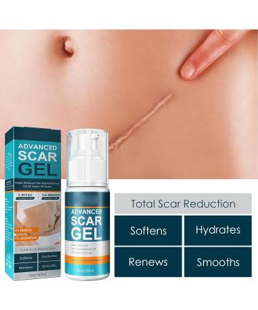 Scar Repair Gel 50ml - Mild Grease-Free Formula for Fading Scars, Wrinkles, Age Spots - Skin Soothing & Absorbing Cream - Buy Online on SooperMarket.com