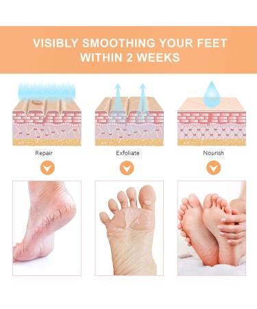Buy Foot Peeling Mask - Gentle Exfoliating Foot Care for Deep Penetration | Ideal for Women | International Shipping - Buy Online on SooperMarket.com