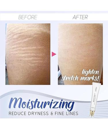 SnowySkin Legs Underarm Cream & Nose Strips Set - Instant Personal Skin Care | White | One Size - Buy Online on SooperMarket.com