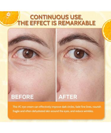 Trendyfave Vitamin C Eye Cream Under Eye Cream for Dark Circles and Puffy Eyes Eye Bags Remover Hydrating Eye Cream Fade Fine Lines Anti Aging Eye Cream for All Women Men Skin - Buy Online on SooperMarket.com