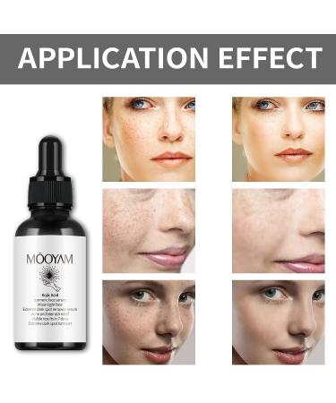 Kojic Acid & Turmeric Dark Spot Corrector Serum | Brightening Face & Body | Sun Spot Remover - 30ml - Buy Online on SooperMarket.com
