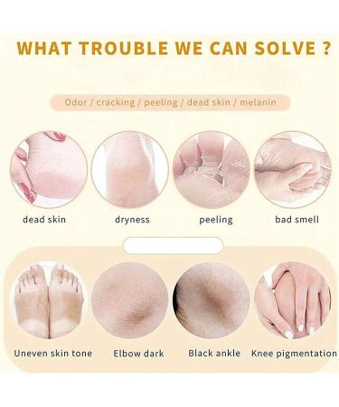 Anushka Foot Peeling Spray Oil | Quick Dead Skin Removal & Hydrating Exfoliation | Effective Callus Treatment - Buy Online on SooperMarket.com